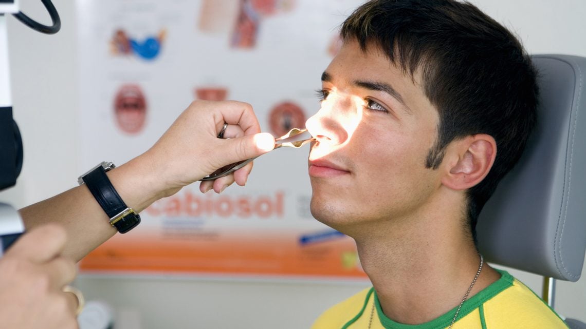 Chronische Nasennebenhöhlen-Entzündung: Ursachen
